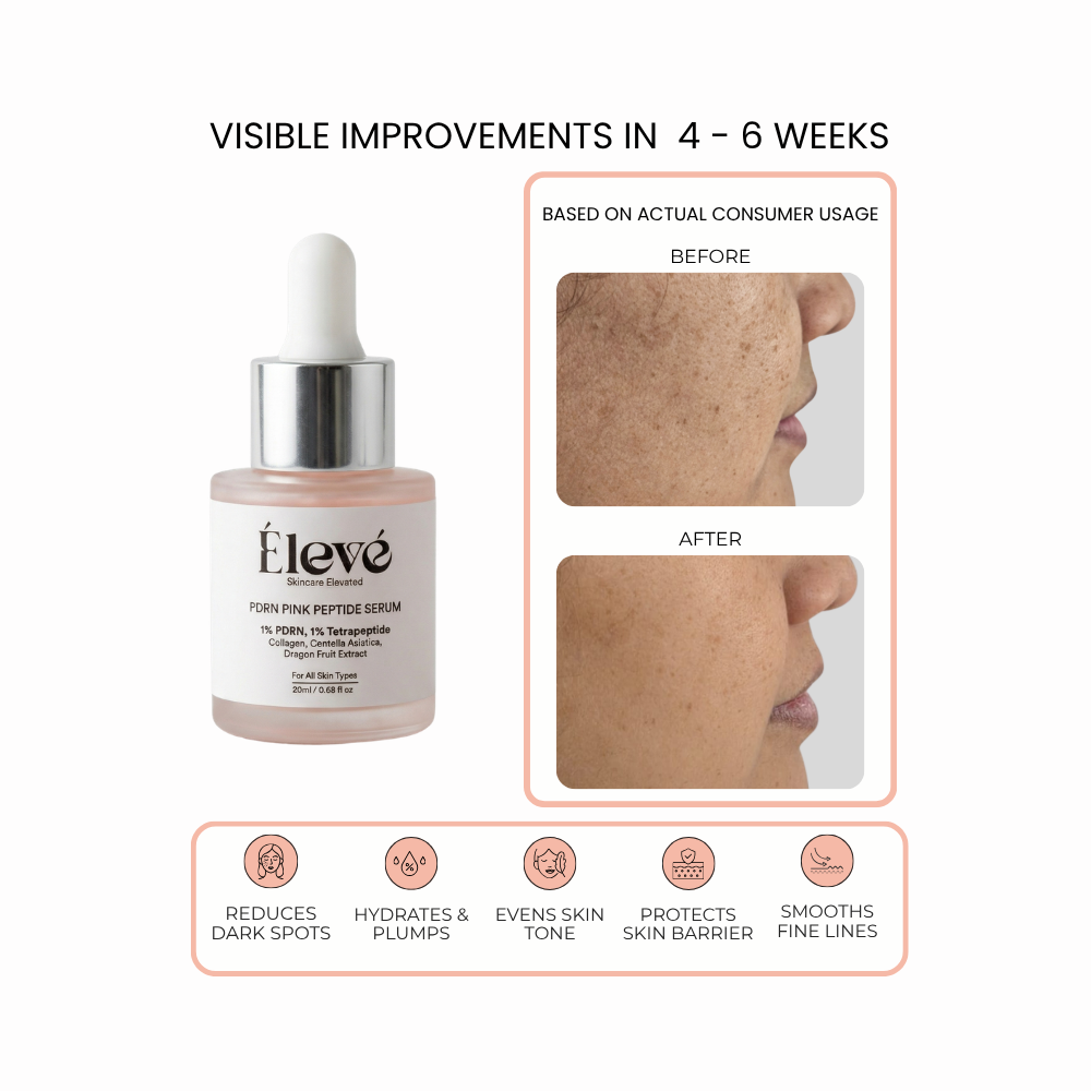 Before and after results showing visible skin improvement after 4–6 weeks of using Eleve PDRN Pink Peptide Serum